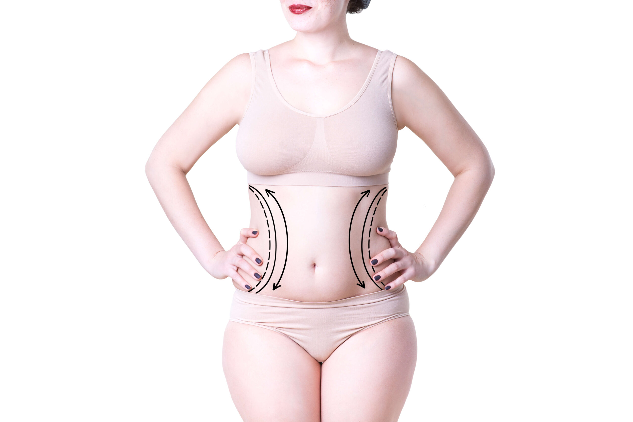 Tummy Tuck Recovery Egozi Plastic Surgery