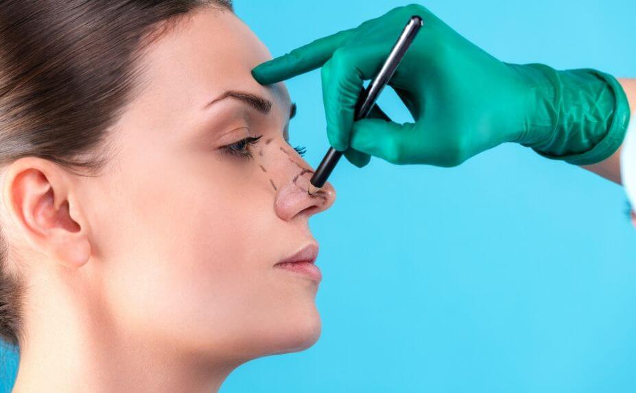 Benefits of Rhinoplasty Surgery