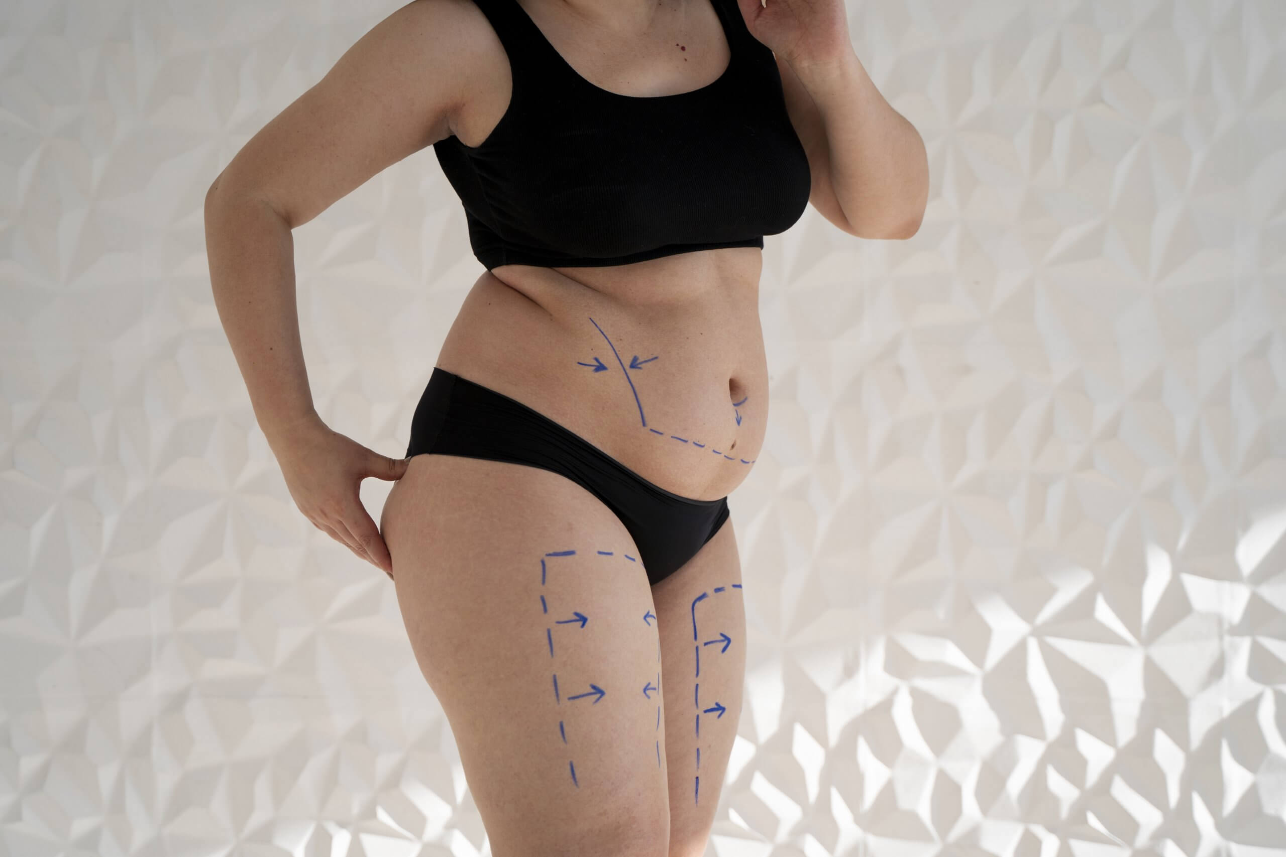 Mommy Makeover at Egozi Plastic Surgery Center