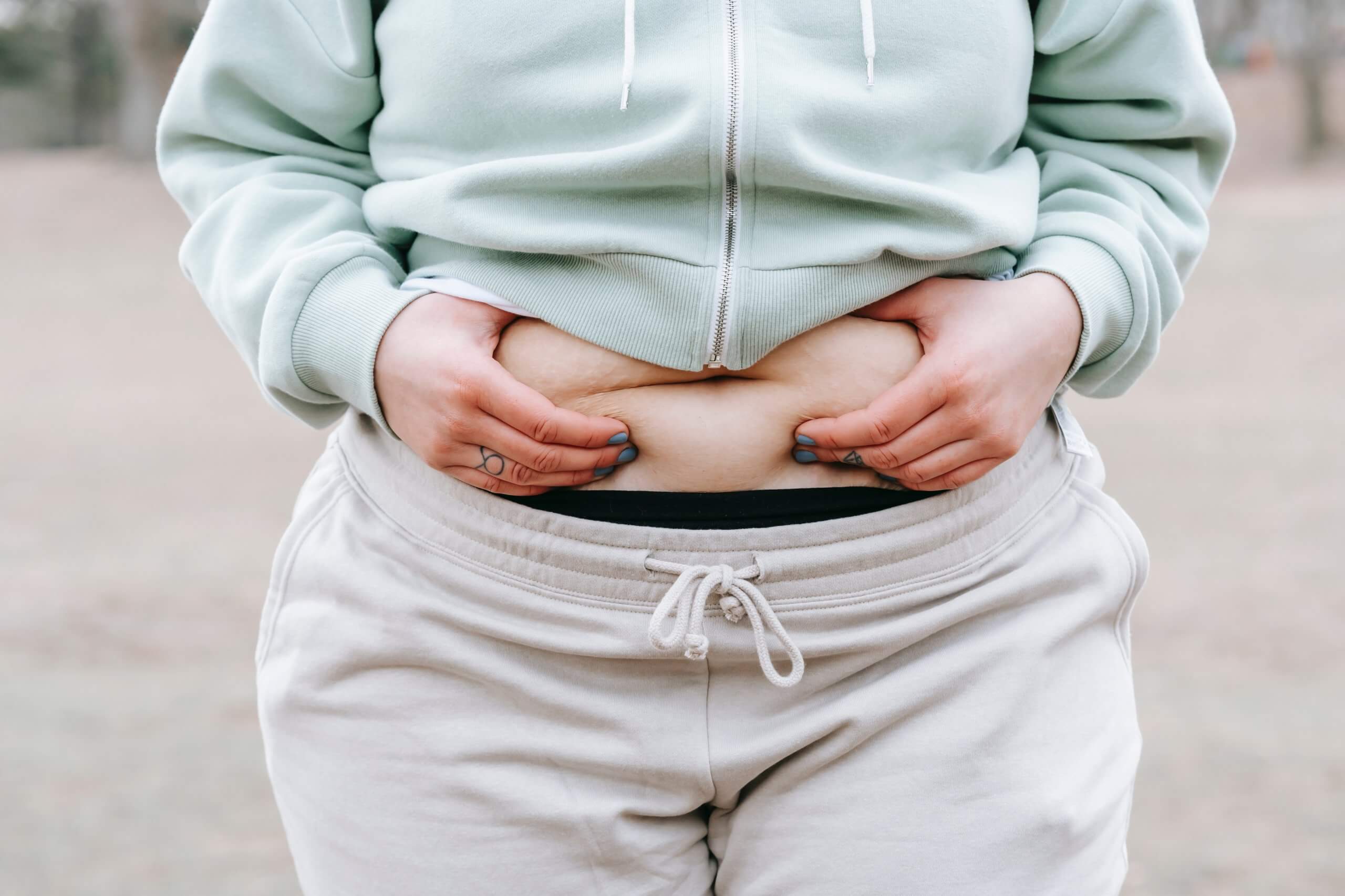 Mini Tummy Tuck at Egozi Plastic Surgery Center