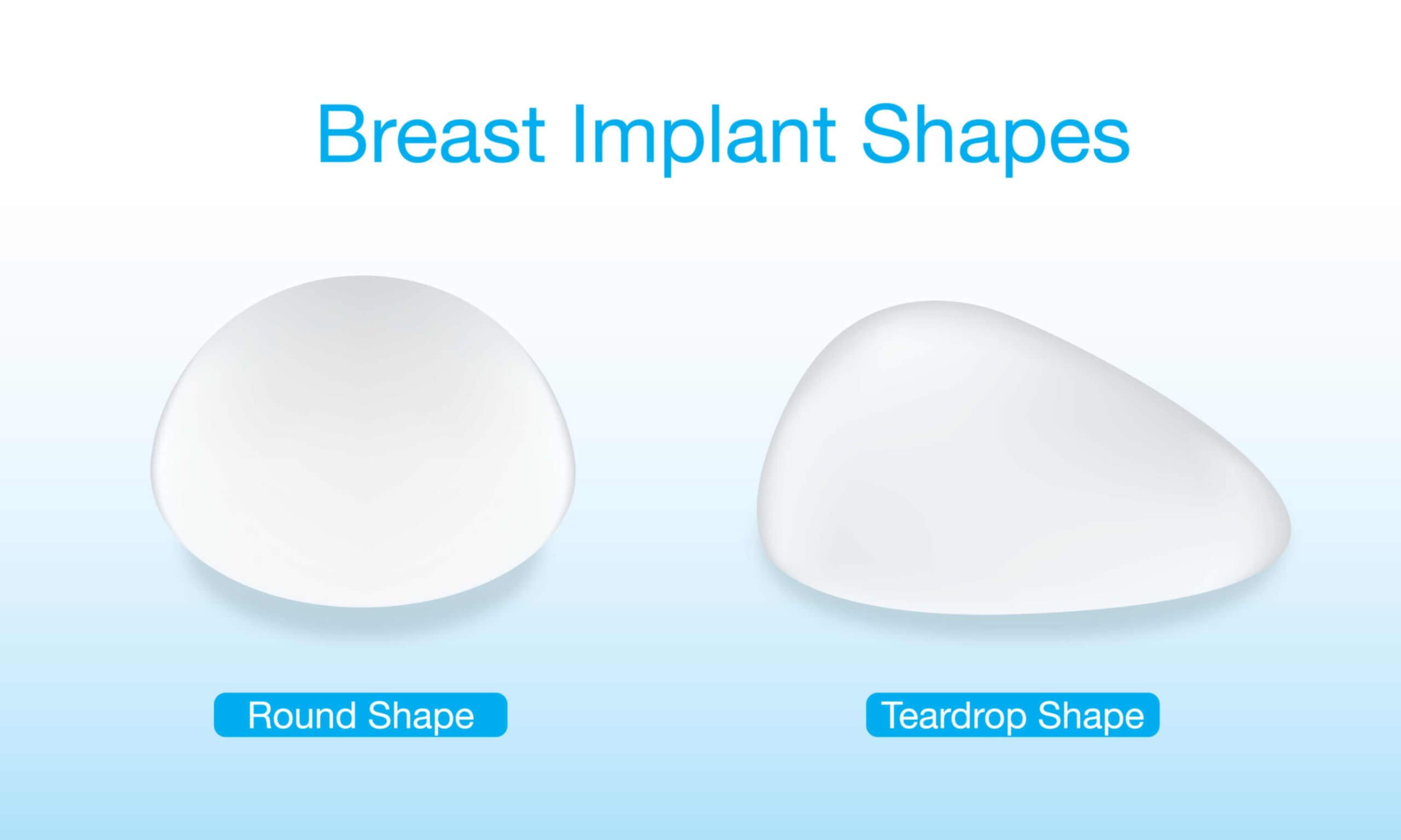 Breast implant shapes
